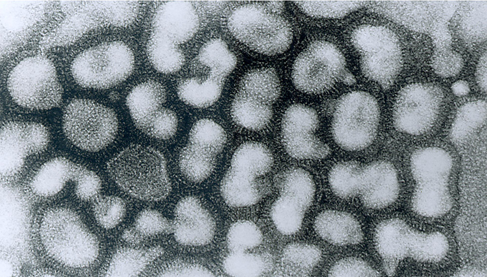 Flu Patients