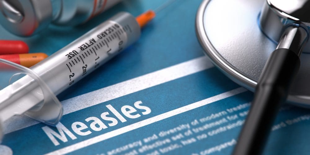 53 Samoans Dead from Measles Outbreak