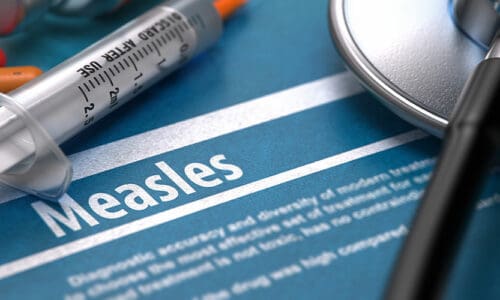 CDC: 20,000 May Have Been Exposed to Measles at Asbury University Revival