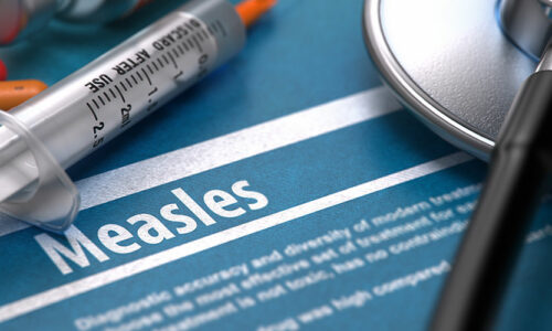 CDC to Healthcare Providers: Be on the Lookout for Measles