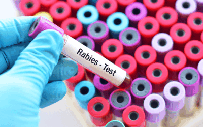 Dos Palos Teacher Bitten by Bat in Classroom Dies of Rabies